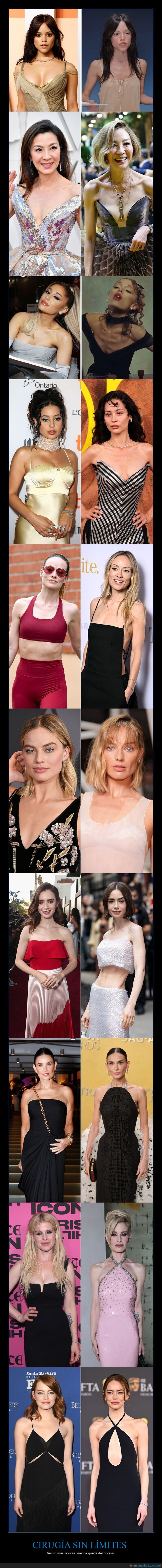 celebridades,cirug&iacute;a,transformaci&oacute;n,fama,est&eacute;tica