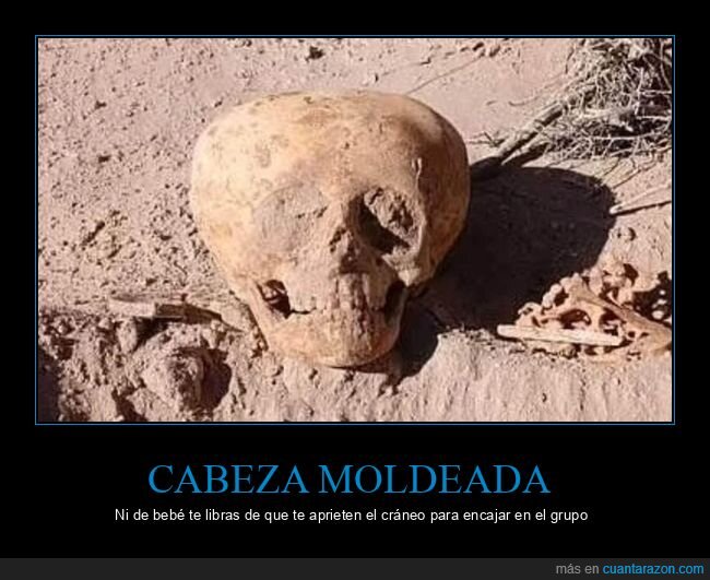 cr&aacute;neo,deformaci&oacute;n,Catamarca,arqueolog&iacute;a,infancia