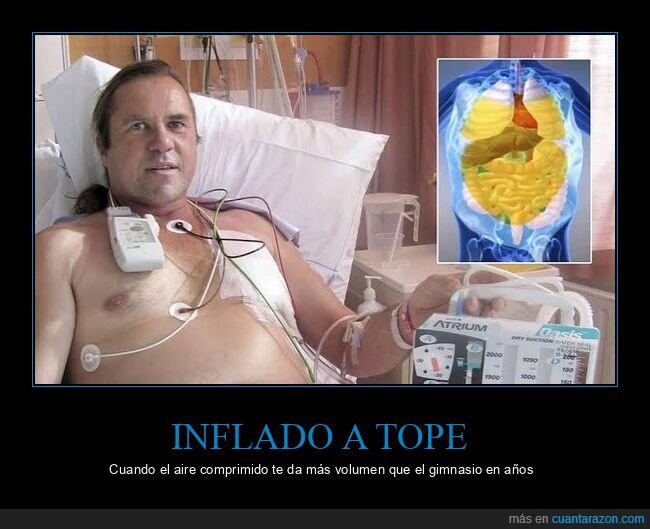 accidente,manguera,hospital,pulmones,supervivencia