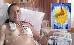 Enlace a El hombre que se infló como un globo al caer sobre una manguera de aire a presión