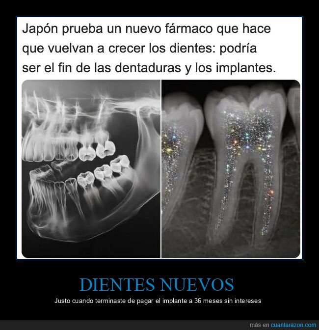 dientes,Jap&oacute;n,dentista,implantes,ciencia