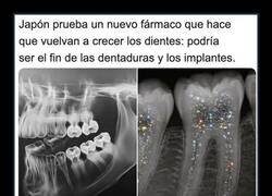 Enlace a La noticia que ningún dentista quiere oír