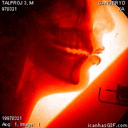 Rayos X,Hablar,radiografía,voz