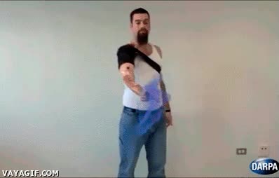 increible,tecnología,coordinar,brazo,prótesis