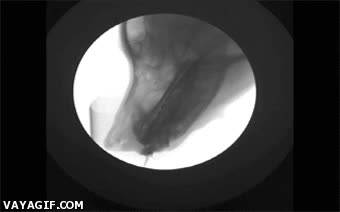 perro,beber,agua,interesante,rayos x,perspectiva,radiografia