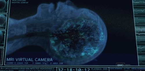 scanner,escanear,Funcion,cerebro,actividad cerebral