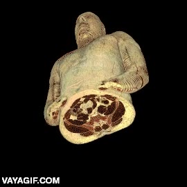 forma,magnetica,cuerpo,humano,ciencia,resonancia