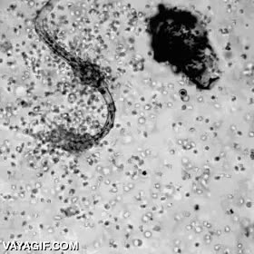 defensas,devorar,globulos blancos,atacar,ataque,sangre