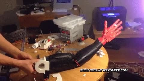 protesis,brazo,dedos,mano,mu&ntilde;eca,codo