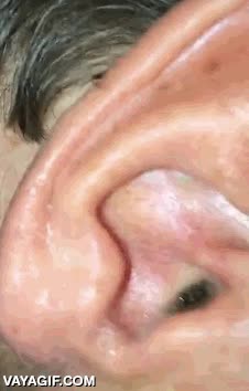 yo me prendo fuego,insecto,araña,bicho,oreja,picor,ahora te pica la oreja y lo sabes