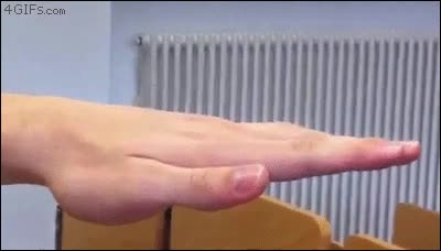 mano,al reves,hiperlaxo.dedos,muy raro