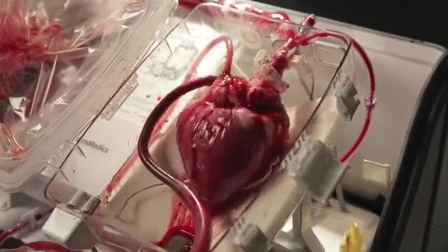 mantener,latido,coraz&oacute;n,antes,transplante