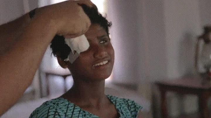 reacci&oacute;n,chica,india,despu&eacute;s,operada