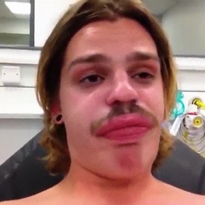 Cuando te pica un insecto en el labio y no puedes evitar grabar un vídeo picar,insecto,labio,evitar,grabar,video