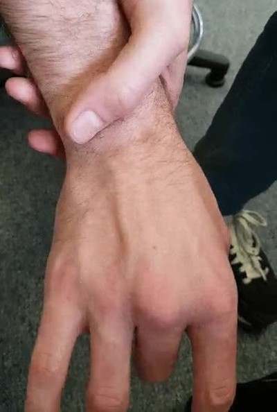 mano,vena,dedos,mover,mal rollo