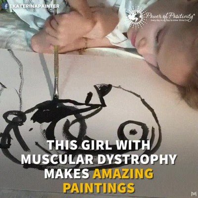 ni&ntilde;a,distrofia muscular,pinturas,alucinantes
