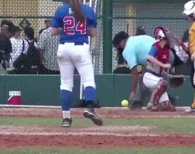 sitio,doloroso,cuerpo,pelota