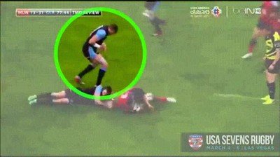 Enlace a Se disloca el hombro y se lo coloca bien en medio del partido