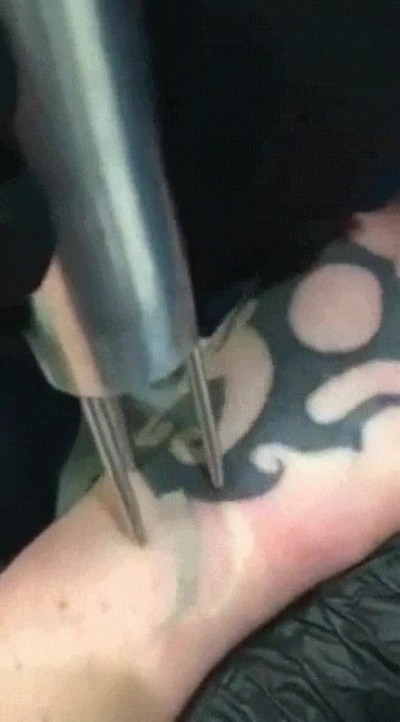 borrar,tatuaje,brazo