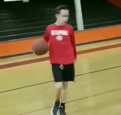 forma,tonta,lesion,basket