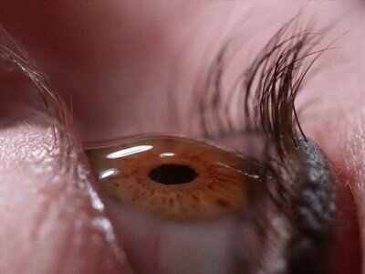Enlace a Así se pone una gota en un ojo a cámara lenta