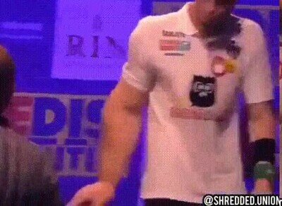 Enlace a El brazo de este chico no tiene ningún sentido