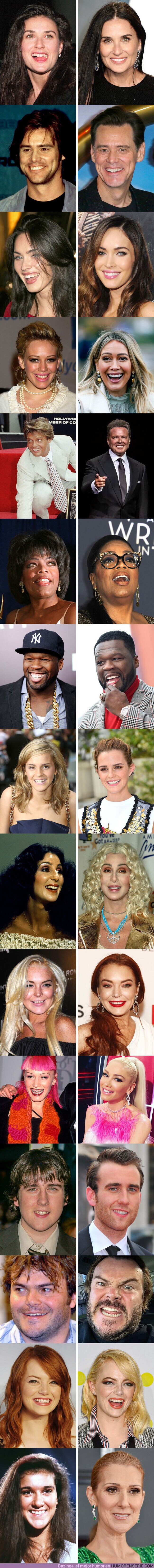 68505 - GALERÍA: Mira cómo cambió la sonrisa de estos 15 famosos luego de que arreglaron sus dientes (nueva edición)