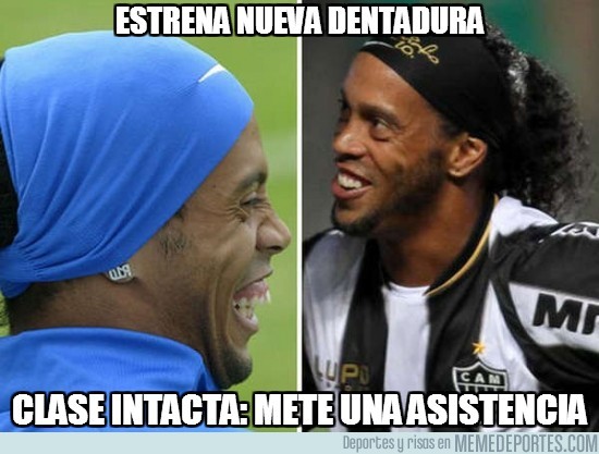 175888 - Ronaldinho estrena nueva dentadura