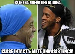 Enlace a Ronaldinho estrena nueva dentadura
