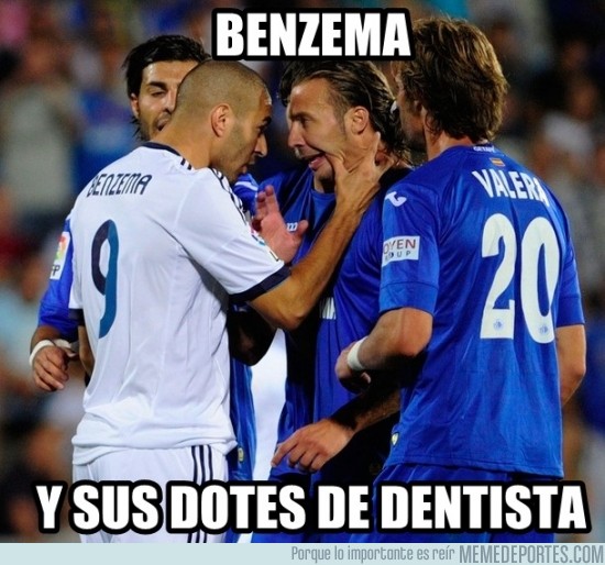 197213 - Benzema y sus dotes de dentista