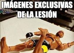 Enlace a Imágenes exclusivas de la lesión de Anderson Silva