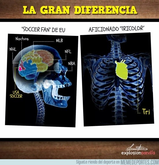 707748 - La gran diferencia entre México y Estados Unidos