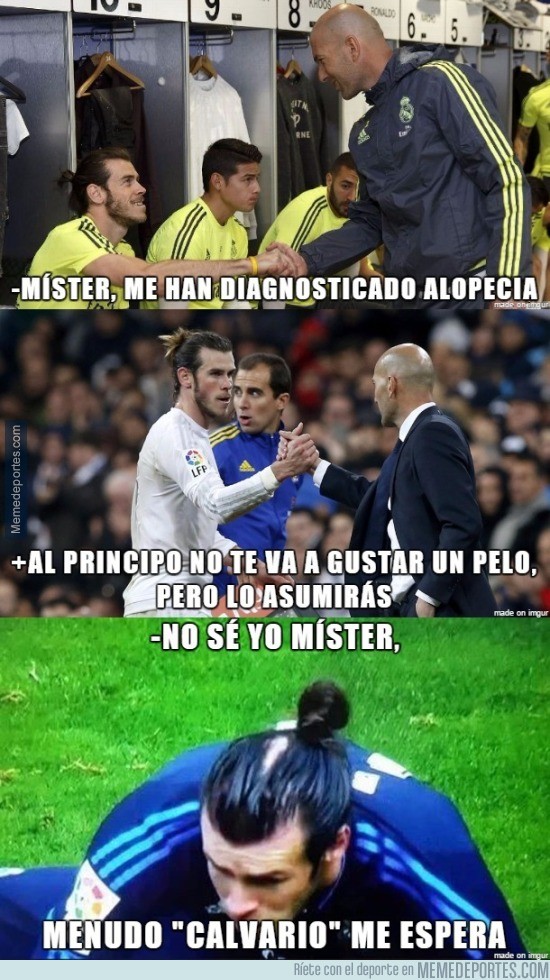 847726 - Bale habló de su calvicie con Zidane
