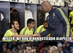 Enlace a Bale habló de su calvicie con Zidane