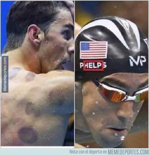 896774 - Michael Phelps está pidiendo ayuda, sus moratones lo indican