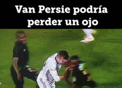 Enlace a Van Persie podría perder el ojo tras este brutal codazo :(