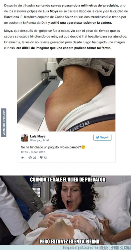 949242 - Así quedó la cadera de Luis Moya tras sufrir un accidente de moto