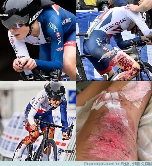 1000326 - Lauren Dolan, ciclista de la carrera de Noruega completó contrareloj con esta escalofriante herida