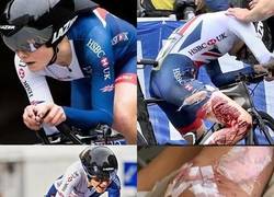 Enlace a Lauren Dolan, ciclista de la carrera de Noruega completó contrareloj con esta escalofriante herida