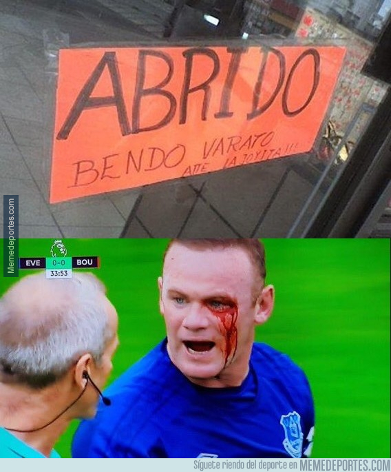 1000568 - La tremenda herida que se ha llevado Rooney 