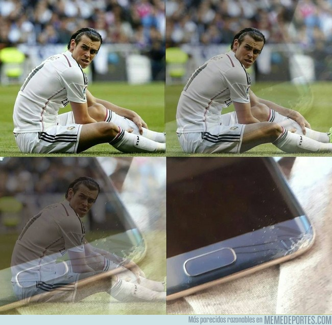 1007410 - Como vemos algunos la lesión de Bale