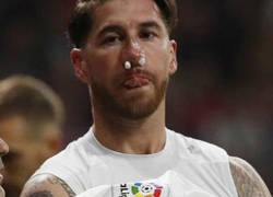 Enlace a Ramos y su parecido más razonable tras tener rota la nariz frente al Atleti