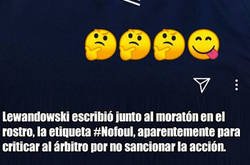 Enlace a Lewandowski muestra las consecuencias del golpe que recibió ante Sevilla y que no fue ni falta