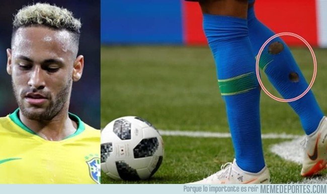 1043204 - La razón por la que Neymar juega con agujeros en las medias durante el Mundial