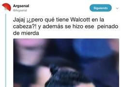 Enlace a ¿Qué se ha hecho Walcott en la cabeza?