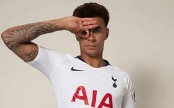 Enlace a Dele Alli trolea a los fans del Arsenal después de que le den un botellazo en toda la cabeza