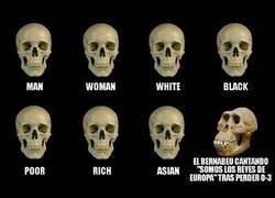 Enlace a La misma historia de los madridistas siempre que pierden