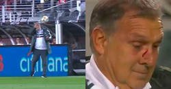 Enlace a El pelotazo de Berizzo al 'Tata' Martino: ¡volaron las gafas y acabó sangrando!