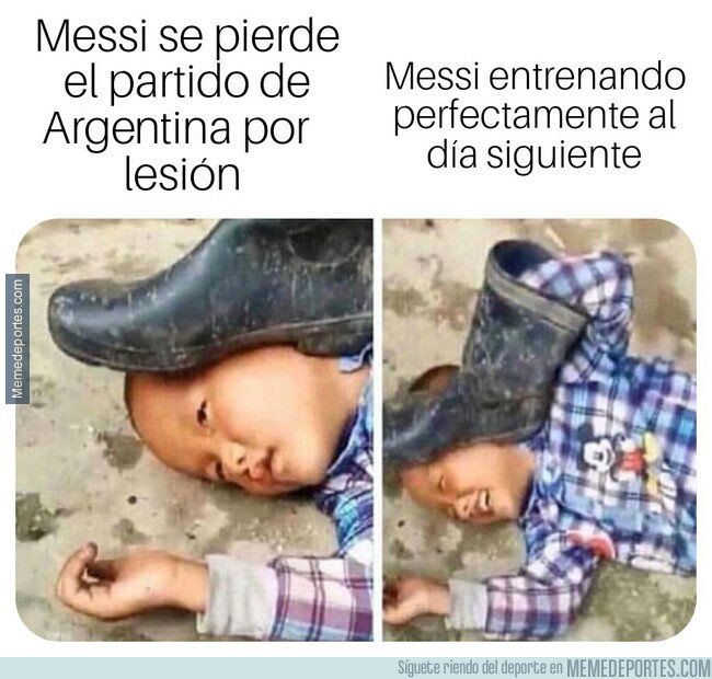 1069606 - Lo de Messi no era tan grave como parecía