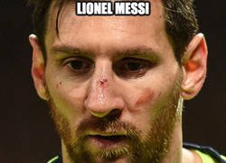 Enlace a Ahora Messi ya conoce a Smalling